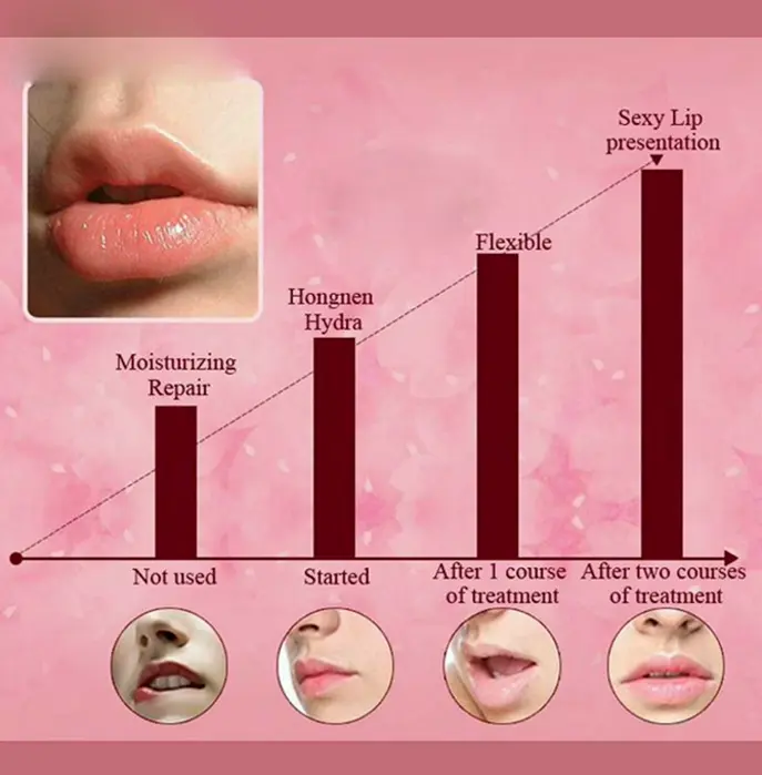 Mouth Mask Pack Rose Gel Sheets Therapy