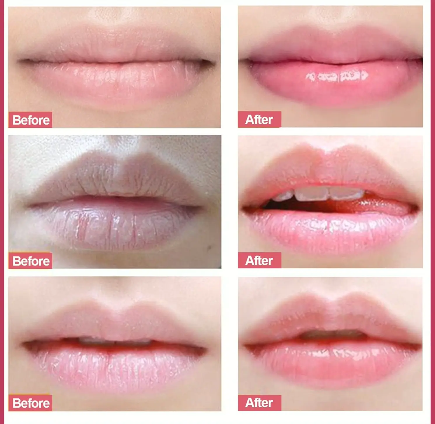 Lip Treatment Exfoliator, Natural Polish for Chapped Skin
