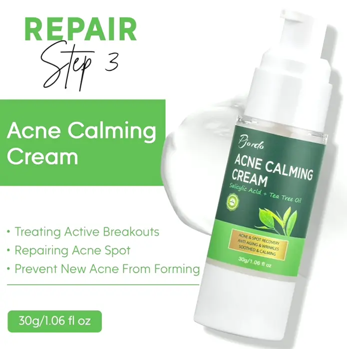 Acne Care Kit with Wash, Refresher, Moisturizer