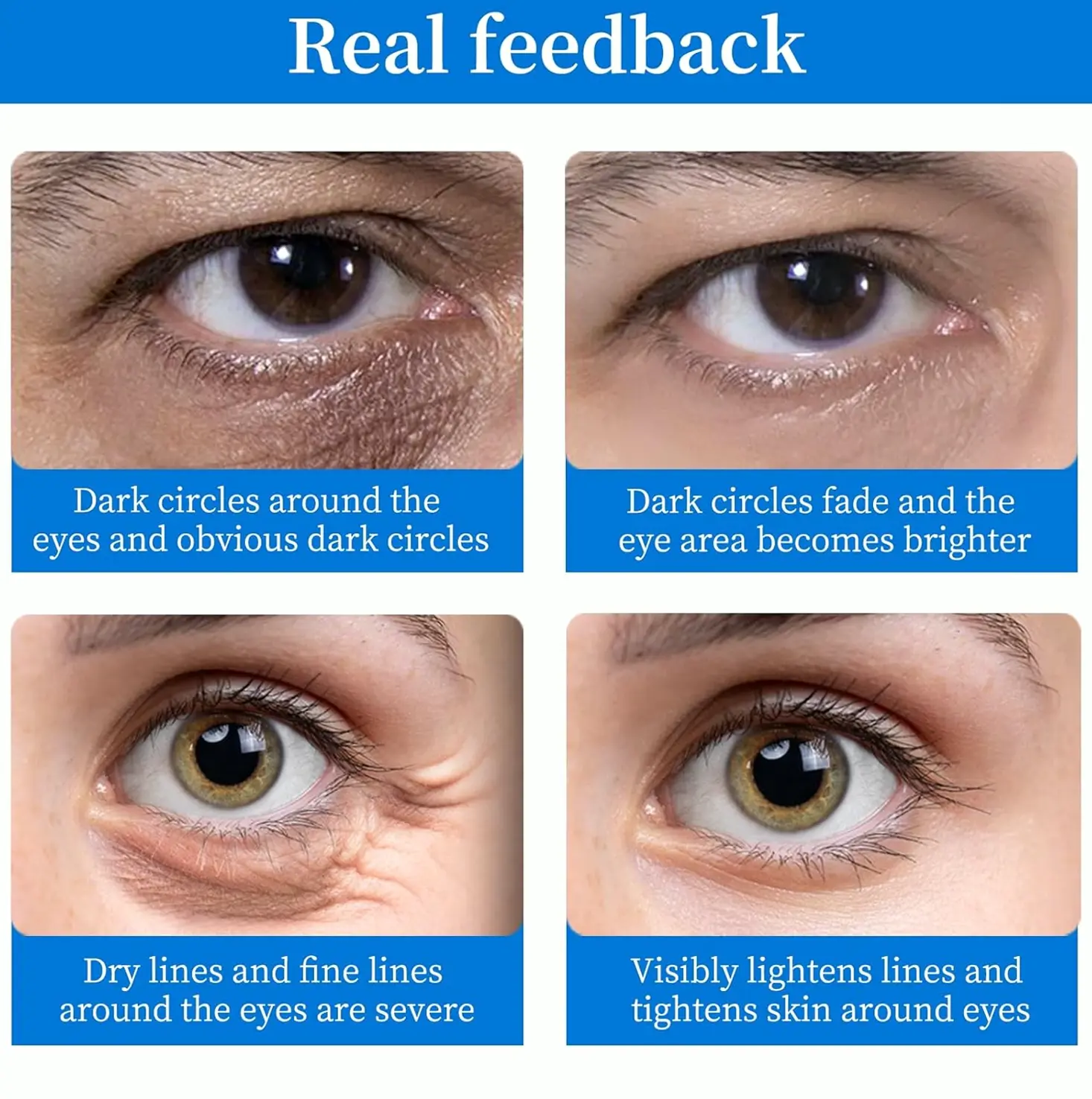 Beneath Eye Patches (64 Pcs) – Chilling & Luminous Hyaluronic Acid Eyes Treatment