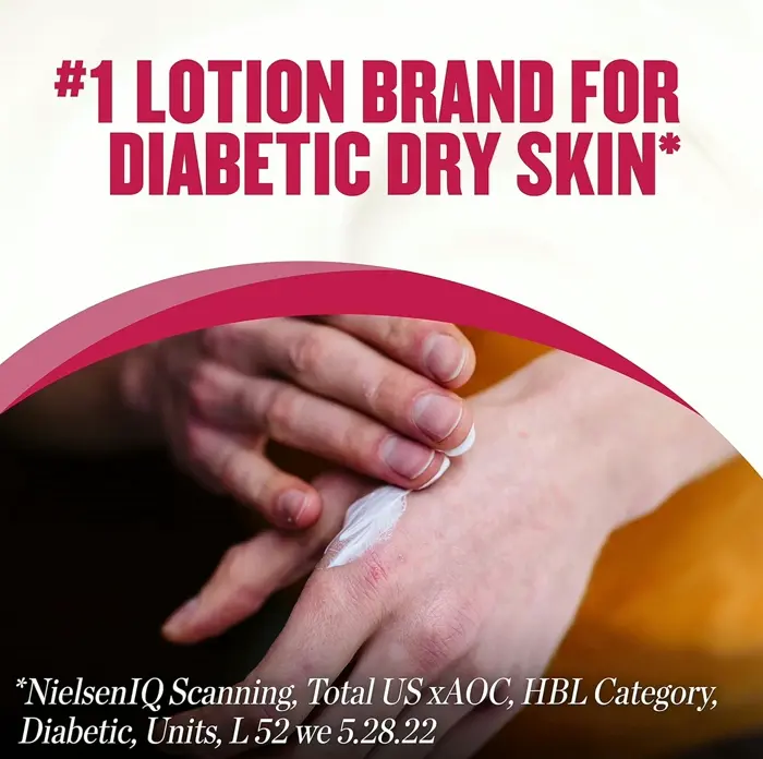 GoldBond Diabetes Dry-skin Relief Hand Cream, 2.4 oz Aloe-Infused