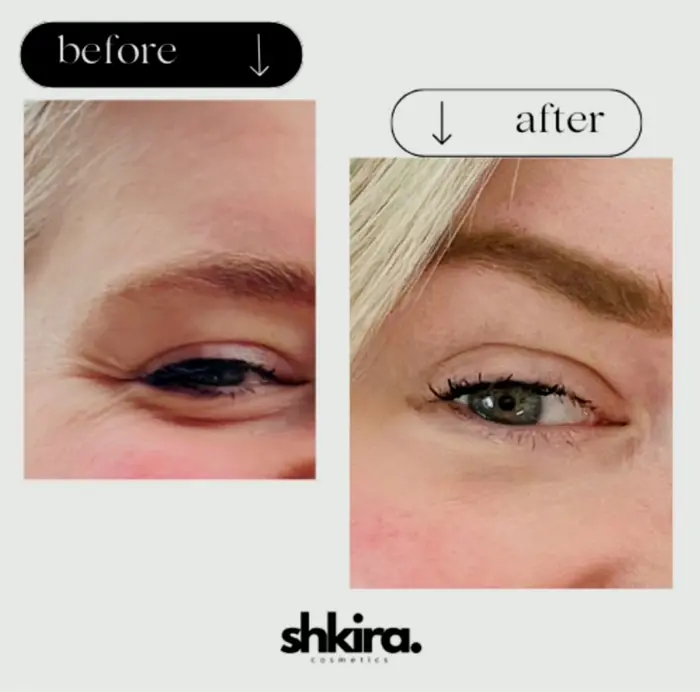 Caffeine Under-Eye Serum | Decreases Swelling & Eye Bags
