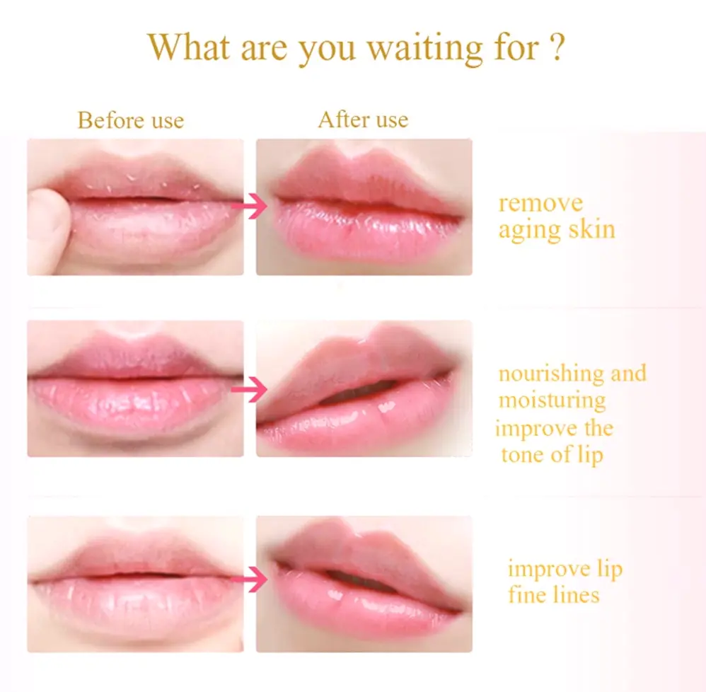 Mouth Mask Pack Rose Gel Sheets Therapy